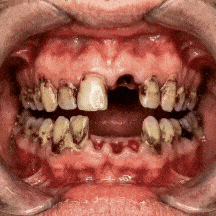 SMILE-1-1.gif
